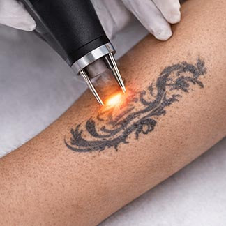 Plateforme Laser Esthétique 2-en-1 Professionnelle – Épilation Diode & Laser Picoseconde